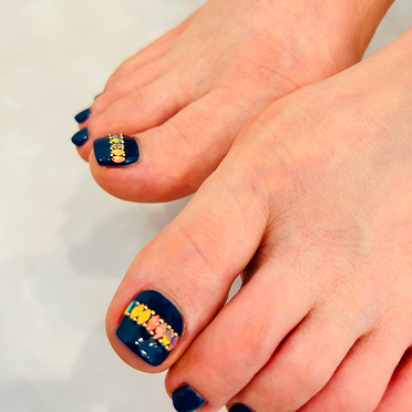 ギャラリーネイル１